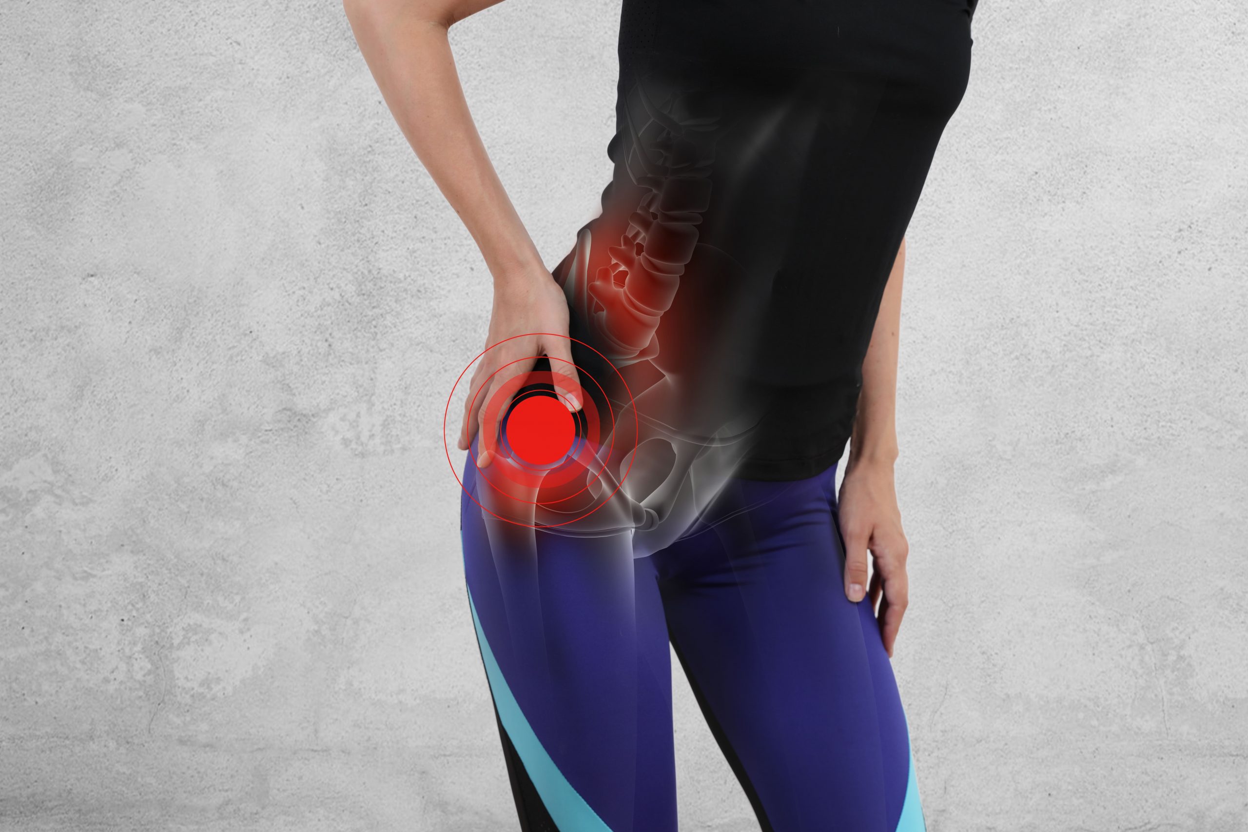 Trochanteric Hip Bursitis: Symptoms Causes Diagnosis Treatment