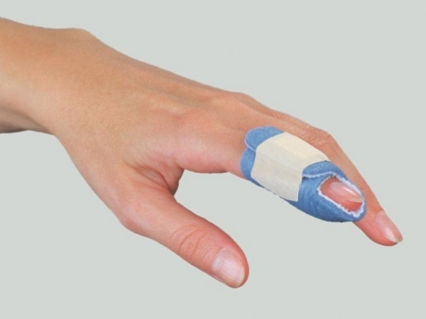 Jarred your finger? It might be fractured Activate