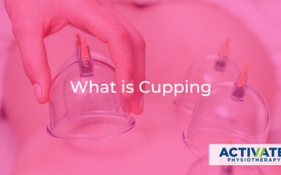 What is Cupping?