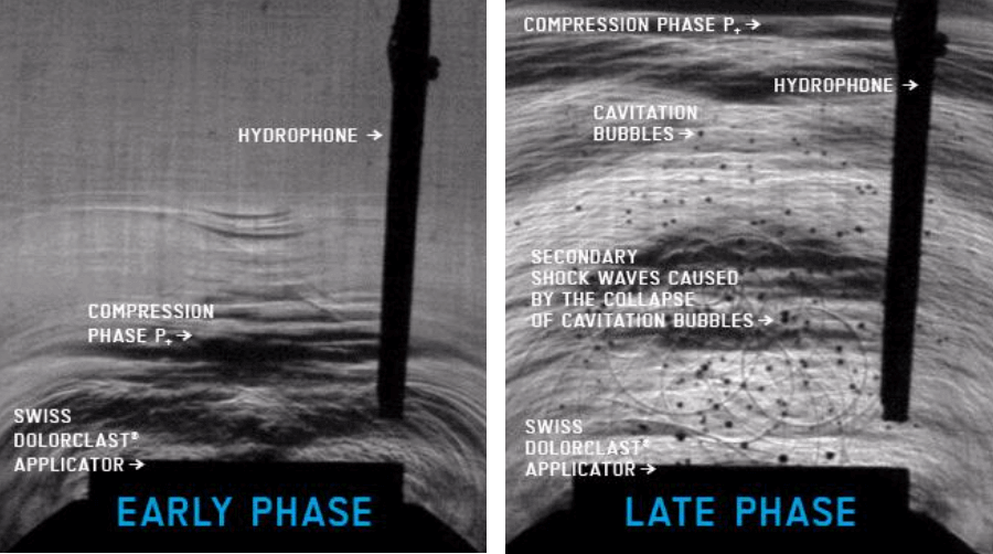 Phases of shockwave