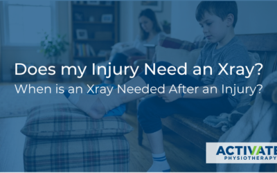 Does My Injury Need an X-ray? When Is an X-ray Needed After an Injury?